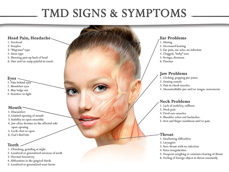 Symptoms Of Tmj Jaw Pain Cause My XXX Hot Girl