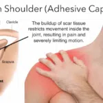 visual of shoulder pain used by beyond wellness, a holistic healing practice in ashburn va