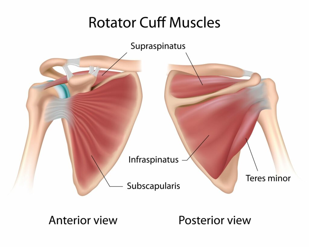 Rotator Cuff Beyond Wellness