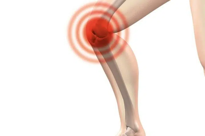 Graphic of where knee has pain before patient comes into Beyond Wellness to see a physical therapist in Ashburn Virginia