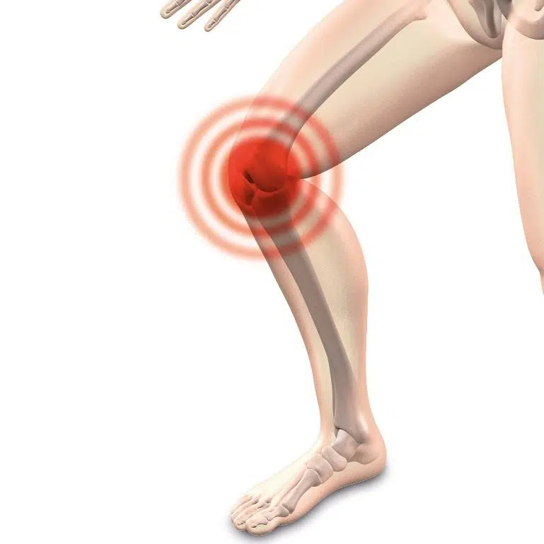Graphic of where knee has pain before patient comes into Beyond Wellness to see a physical therapist in Ashburn Virginia